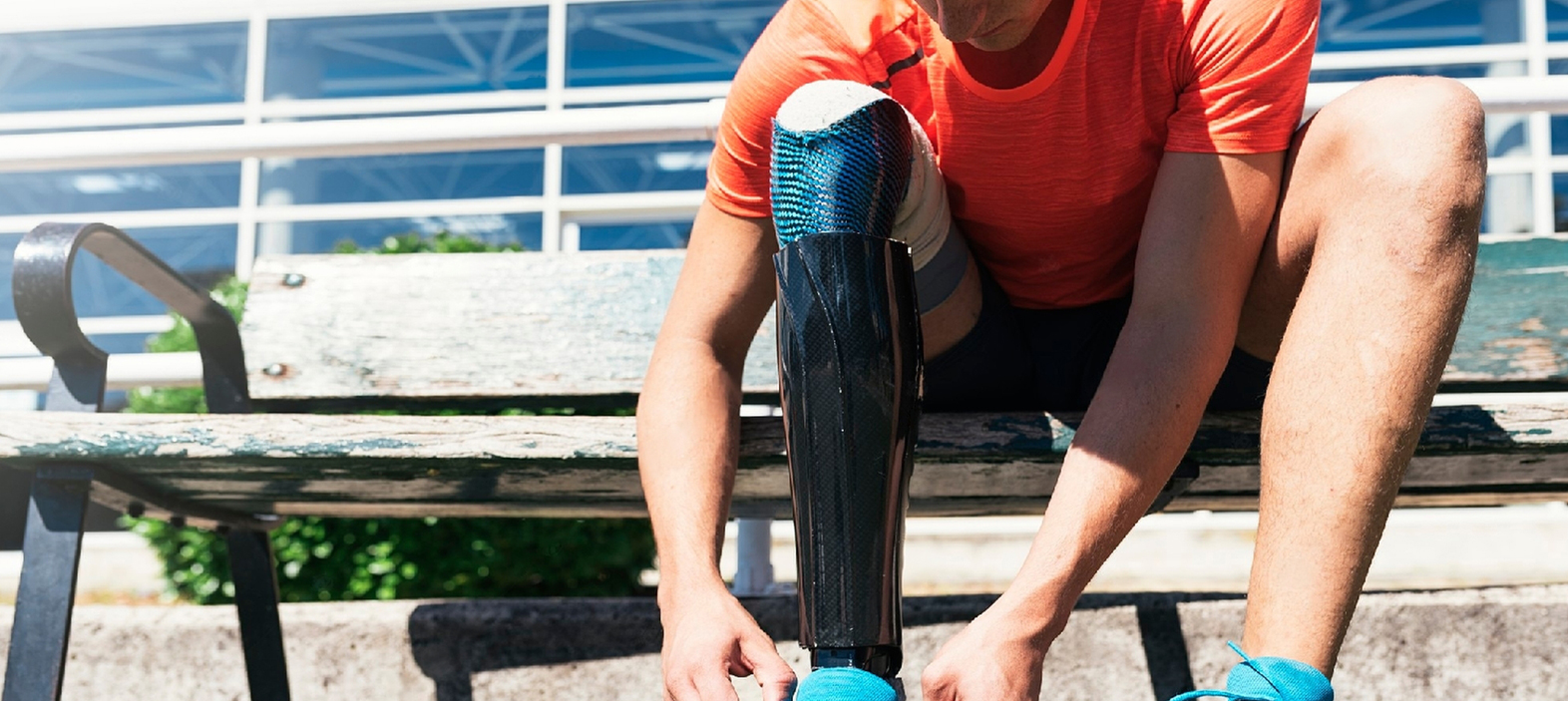 Transtibial (Below Knee) Prosthetics